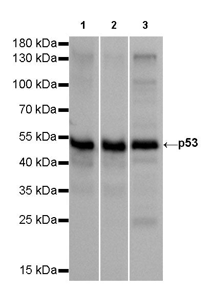 p53 Recombinant Rabbit mAb (SDT-100-72)