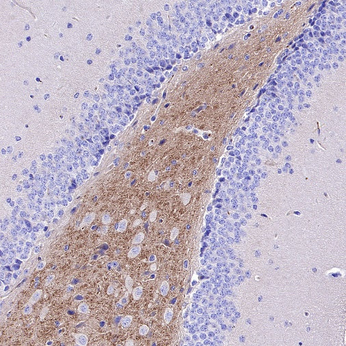 BACE1 Recombinant Rabbit mAb (S-2514-34)