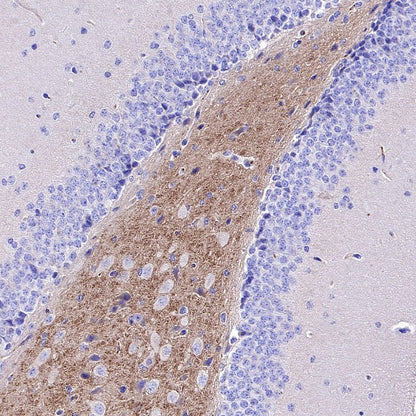 BACE1 Recombinant Rabbit mAb (S-2514-34)