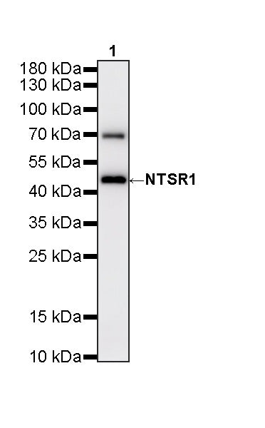 NTSR1 Recombinant Rabbit mAb (S-4844-38)