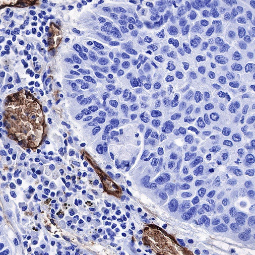Aquaporin 1/AQP1 Recombinant Rabbit mAb (S-794-79)