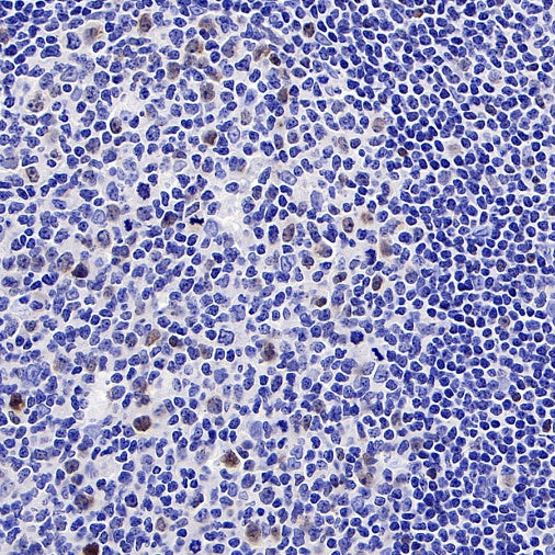 c-Myc Recombinant Rabbit mAb (S-519-54)
