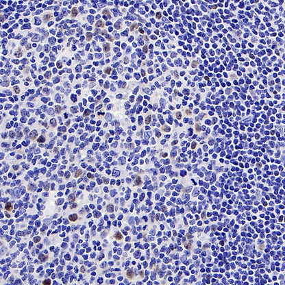 c-Myc Recombinant Rabbit mAb (S-519-54)