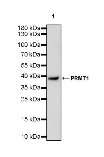 PRMT1 Recombinant Rabbit mAb (S-884-10)