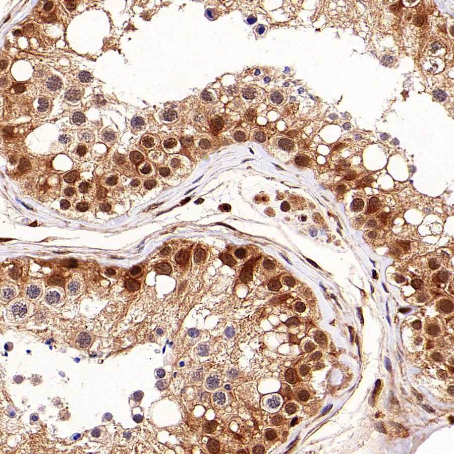 GRB2 Recombinant Rabbit mAb (S-5948)