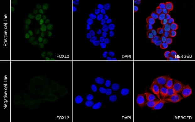 FOXL2 Recombinant Rabbit mAb (SDT-557-361)