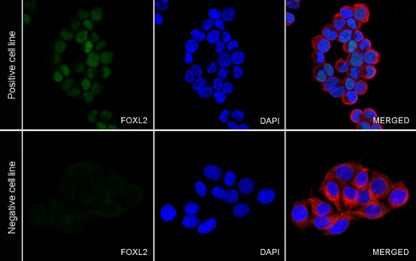 FOXL2 Recombinant Rabbit mAb (SDT-557-361)