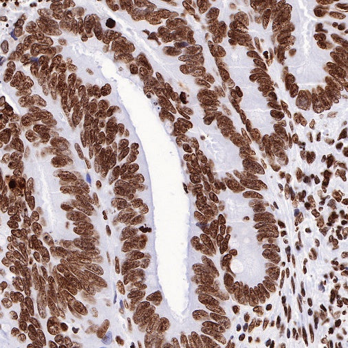 Histone H3 (mono methyl K36) Recombinant Rabbit mAb (S-R211)