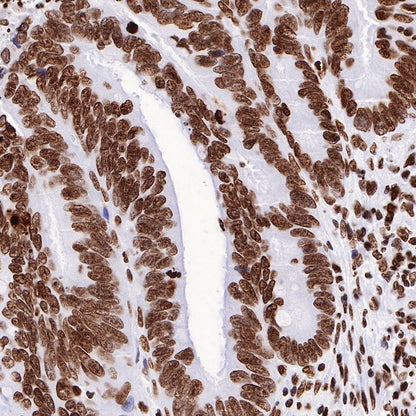 Histone H3 (mono methyl K36) Recombinant Rabbit mAb (S-R211)
