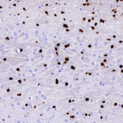 S-RMab® SOX10 Recombinant Rabbit mAb (SDT-R233)