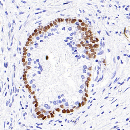 p40 Recombinant Rabbit mAb (SDT-166-116)