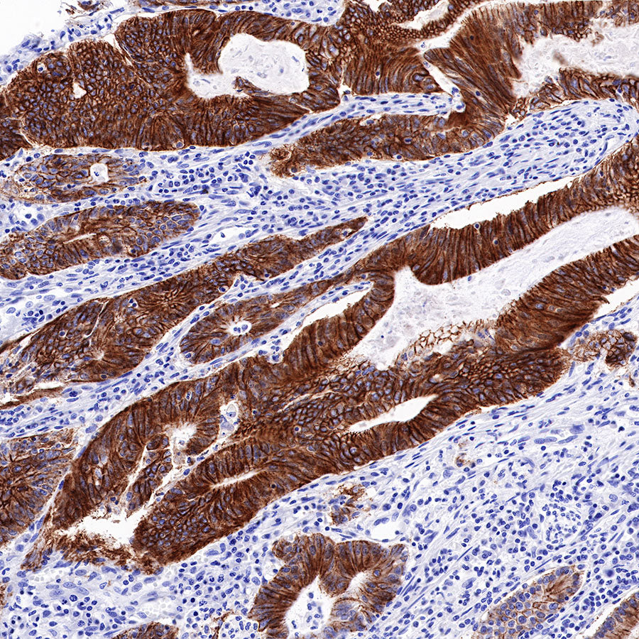 Cadherin 17 Recombinant Rabbit mAb,PBS Only (SDT-R151)