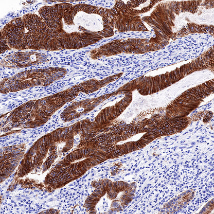 Cadherin 17 Recombinant Rabbit mAb,PBS Only (SDT-R151)