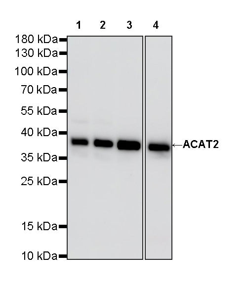 ACAT2 Recombinant Rabbit mAb