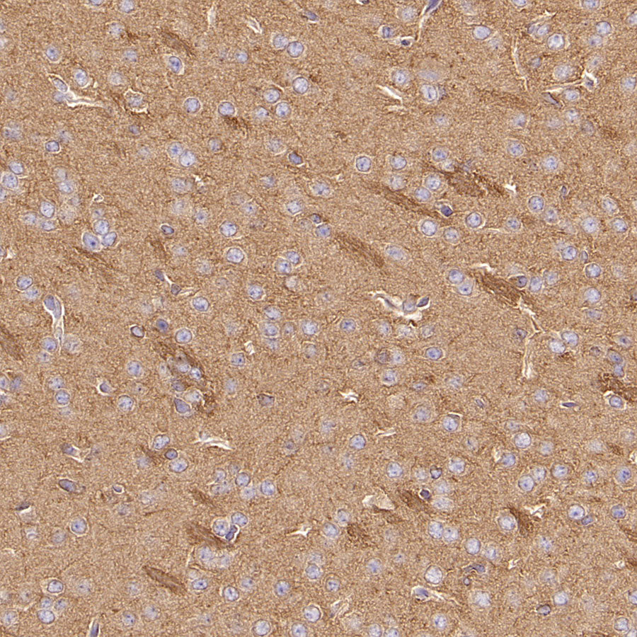 CDS2 Recombinant Rabbit mAb (S-3670-56)