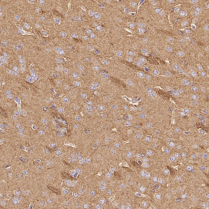 CDS2 Recombinant Rabbit mAb (S-3670-56)