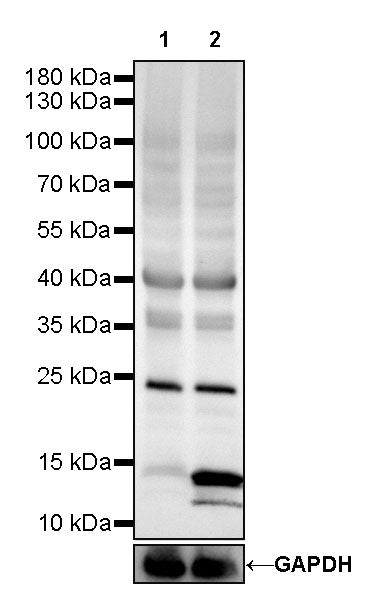 Acetyllysine Recombinant Rabbit mAb (SDT-R096)