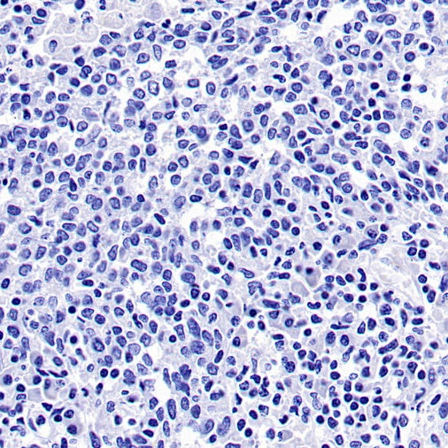 PMEL/Melanoma gp100 Recombinant Rabbit mAb (SDT-3393)