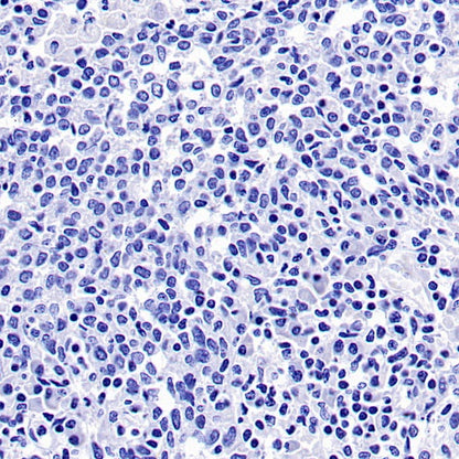 PMEL/Melanoma gp100 Recombinant Rabbit mAb (SDT-3393)