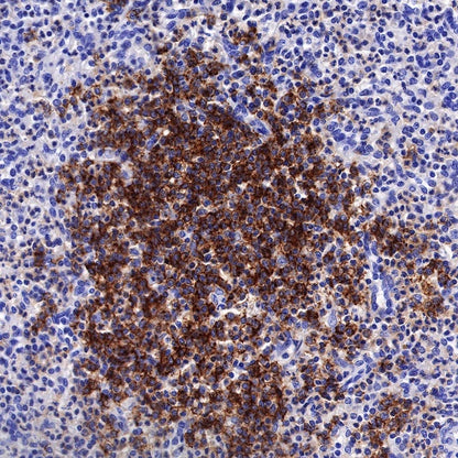 CD35 Recombinant Rabbit mAb (SDT-R224)