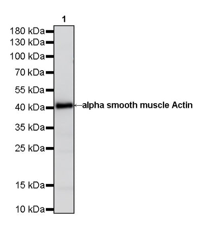 alpha smooth muscle Actin Recombinant Mouse mAb (SDT-R142)