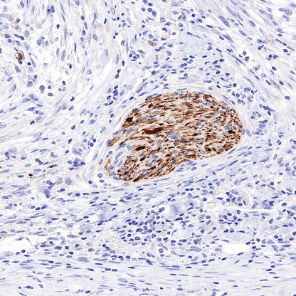 PGP9.5 Recombinant Rabbit mAb (SDT-665-37)
