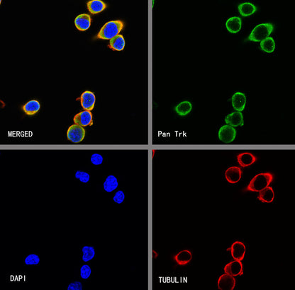 S-RMab® Pan Trk Recombinant Rabbit mAb (SDT-512-5)