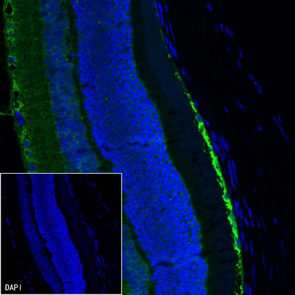 CRALBP Rabbit Polyclonal Antibody