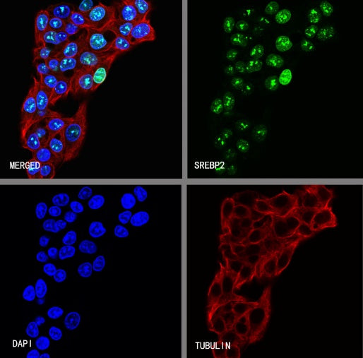 SREBP2 Recombinant Rabbit mAb (S-2701-1)