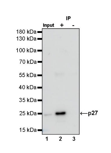 p27 Recombinant Rabbit mAb (S-141-135)