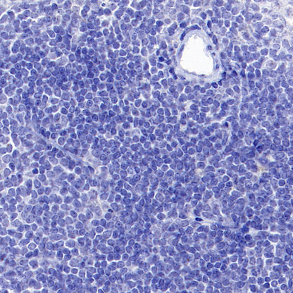 Olfactory Marker/OMP Recombinant Rabbit mAb (S-3513-32)