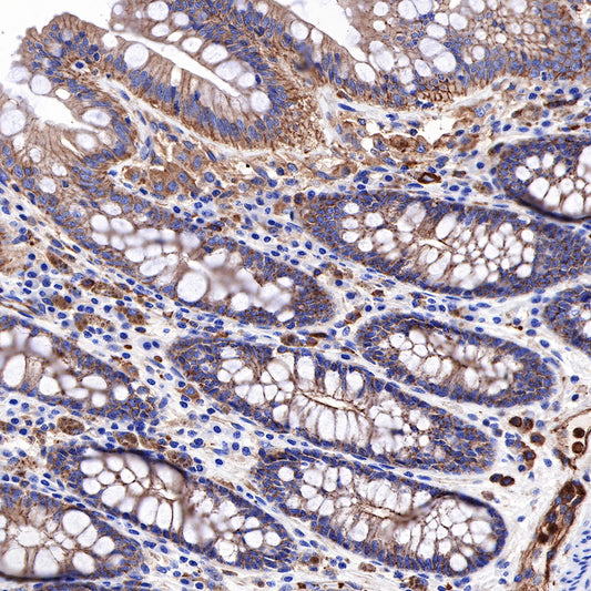 α-Actinin-1 Recombinant Rabbit mAb (SDT-311-20)