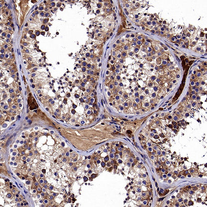 SQLE Recombinant Rabbit mAb (S-2358-207)
