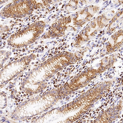 SHMT2/SHMT Recombinant Rabbit mAb (S-1581-5)