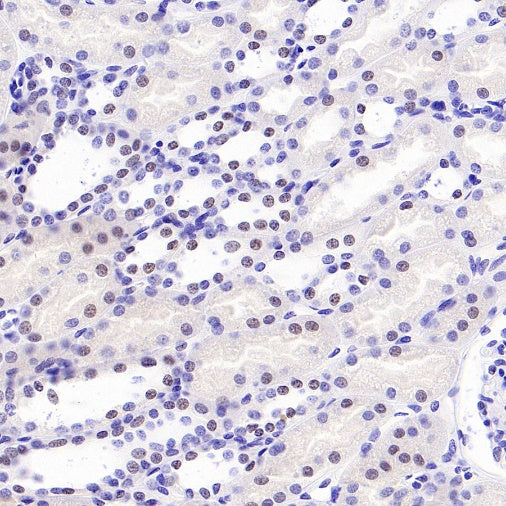 Histone H3 (acetyl K4) Recombinant Rabbit mAb (S-848-137)