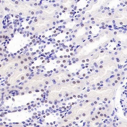 Histone H3 (acetyl K4) Recombinant Rabbit mAb (S-848-137)