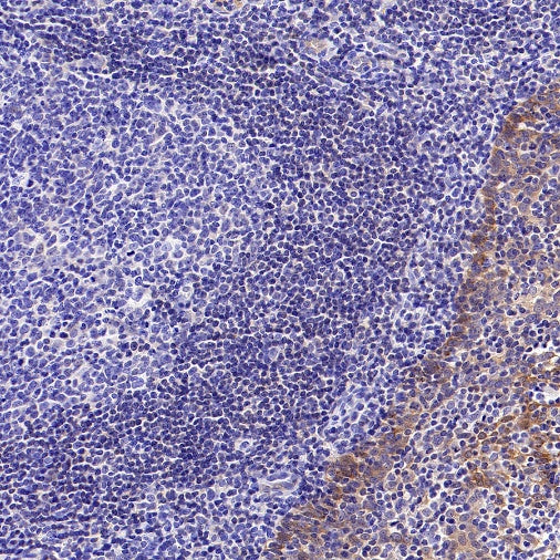 p90RSK Recombinant Rabbit mAb (S-1024-26)