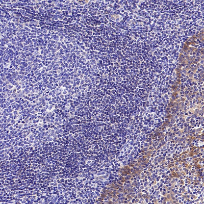 p90RSK Recombinant Rabbit mAb (S-1024-26)