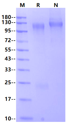 Ebola virus EBOV (subtype Zaire, strain H.sapiens-wt/GIN/2014/Makona-Kissidougou-C15) GP / Glycoprotein Protein (His Tag)