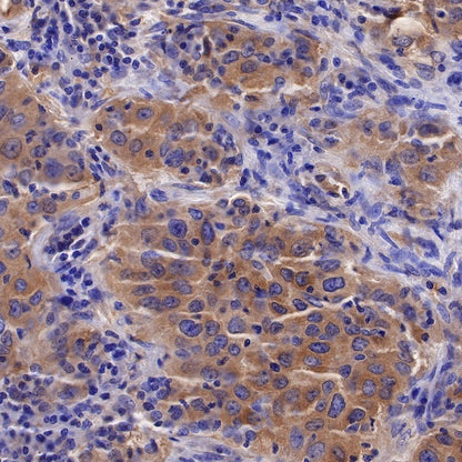 Calpastatin Recombinant Rabbit mAb (S-R184)