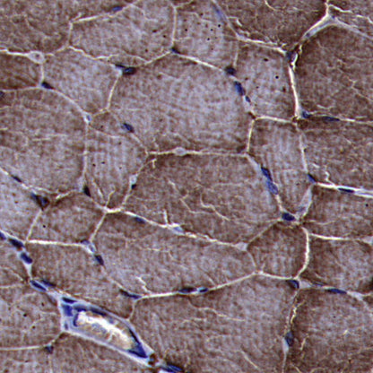 BIN1 Recombinant Rabbit mAb (S-4287-18)