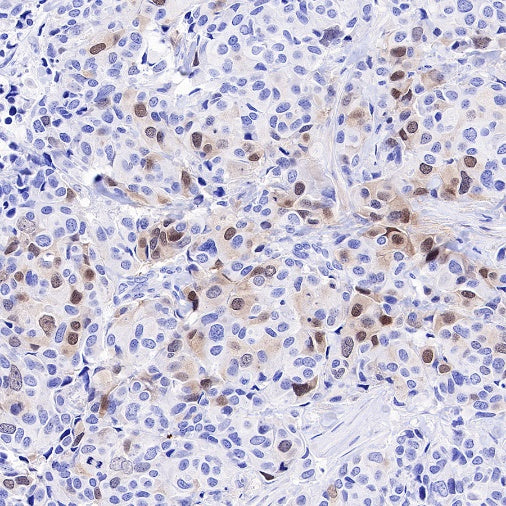 Rad51 Recombinant Rabbit mAb (S-R347)