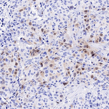 Rad51 Recombinant Rabbit mAb (S-R347)