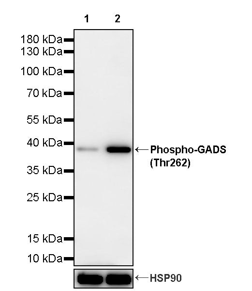 Phospho-GADS (Thr262) Recombinant Rabbit mAb (S-4987)