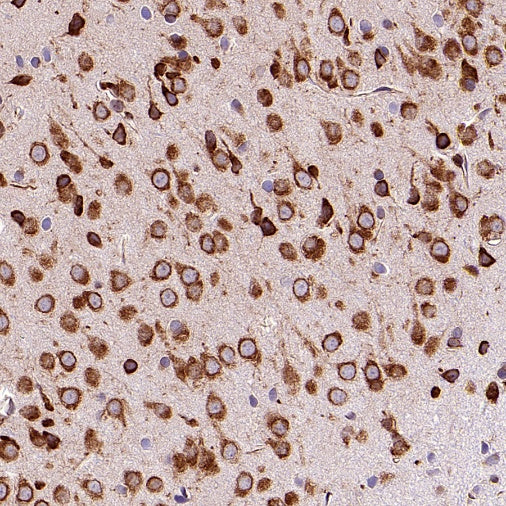 Argonaute 2 Recombinant Rabbit mAb (S-2620-13)
