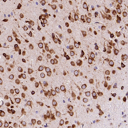 Argonaute 2 Recombinant Rabbit mAb (S-2620-13)