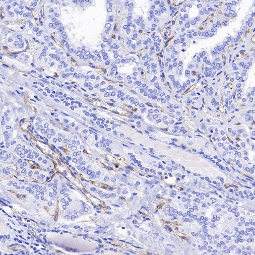 VEGF Receptor 2/FLK-1 Recombinant Rabbit mAb (SDT-1519-144)