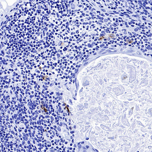CCL17 Recombinant Rabbit mAb (S-1847-7)