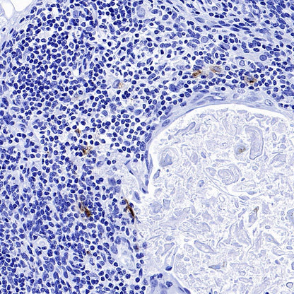 CCL17 Recombinant Rabbit mAb (S-1847-7)
