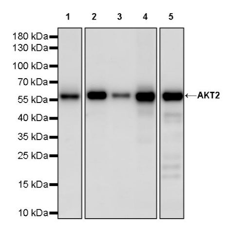 AKT2 Recombinant Rabbit mAb (S-2617-6)
